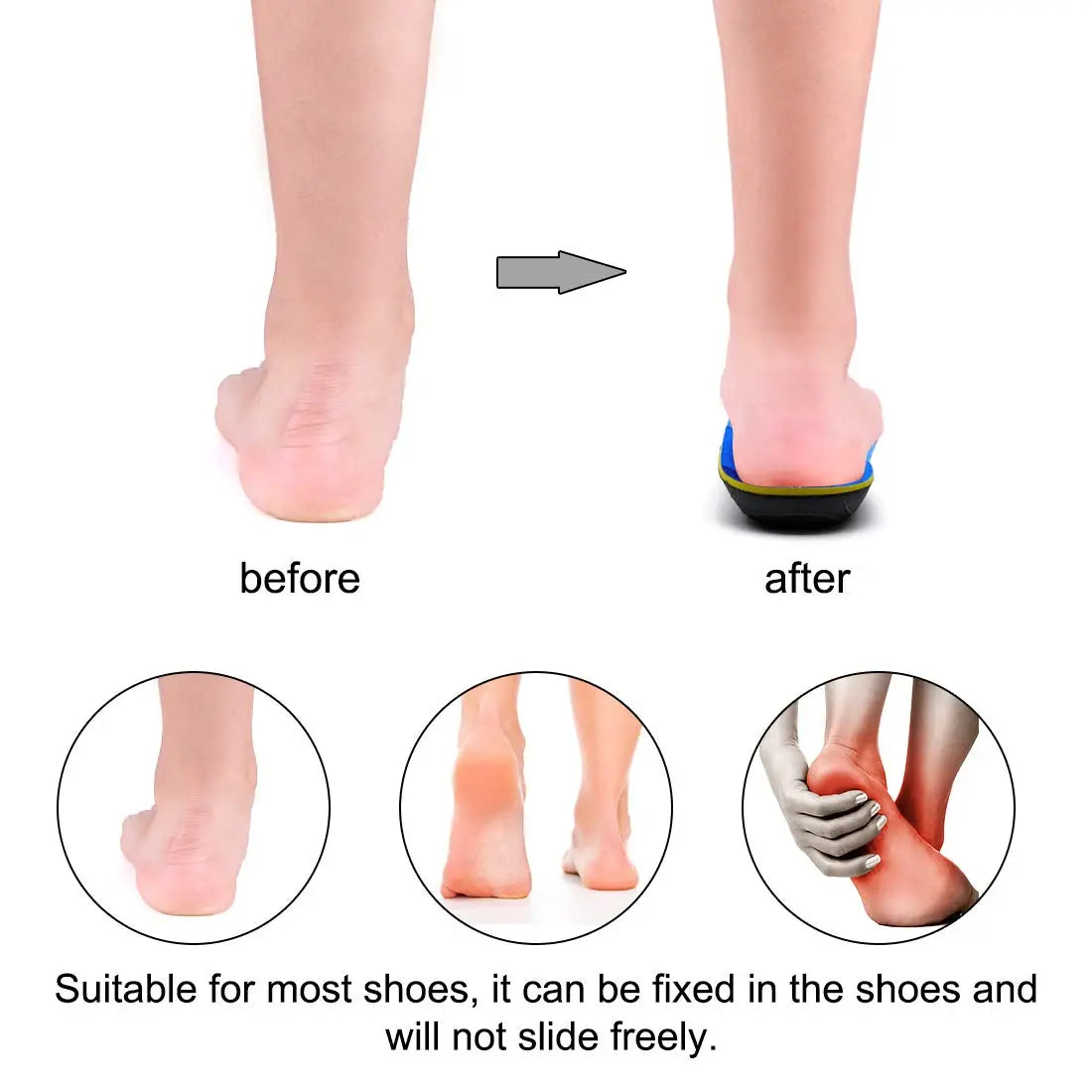 Severe Flat Foot Orthotic Insole Plantar Fasciitis Relieve Heel Pain